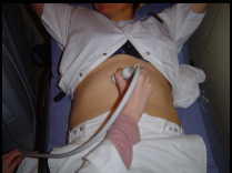 Initiation à l'échographie abdominale