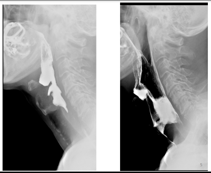 Contraste digestif en radiologie adulte