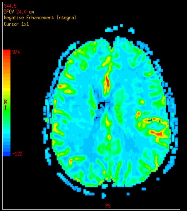 Let it Flow, Feel the Glow